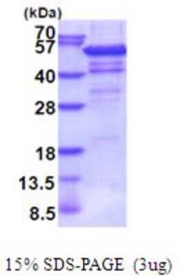 SDS-PAGE: Recombinant Human IHPK2 His Protein [NBP2-51982]