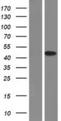 Western Blot: IkB-alpha Overexpression Lysate [NBP2-06636]