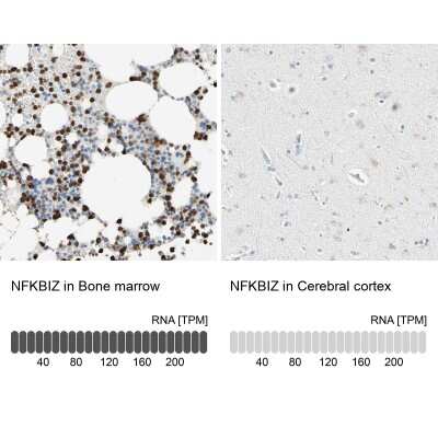 Immunohistochemistry-Paraffin: IKB zeta Antibody [NBP1-89835]