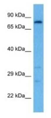 Western Blot: IKB zeta Antibody [NBP3-10987]