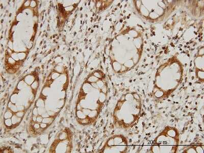 Immunohistochemistry-Paraffin: IKBKAP Antibody (6G9) [H00008518-M03]
