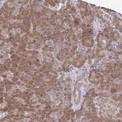 Immunohistochemistry: IKBKAP Antibody [NBP2-48973]