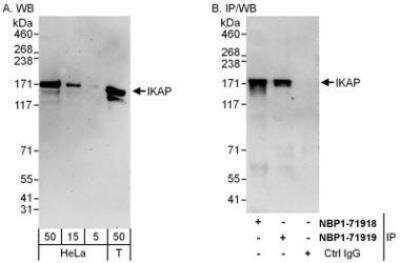 Western Blot: IKBKAP Antibody [NBP1-71918]