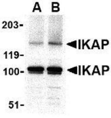 Western Blot: IKBKAP AntibodyBSA Free [NBP1-76788]