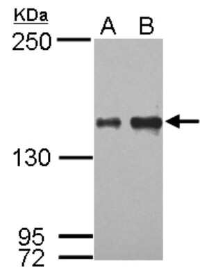 Western Blot: IKBKAP Antibody [NBP2-16936]