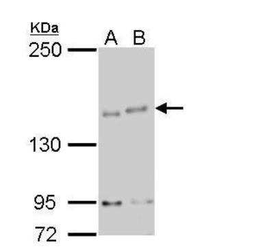 Western Blot: IKBKAP Antibody [NBP2-16936]