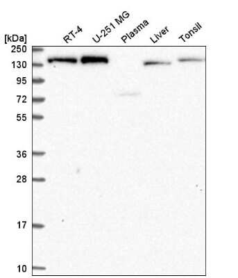 Western Blot: IKBKAP Antibody [NBP2-56082]