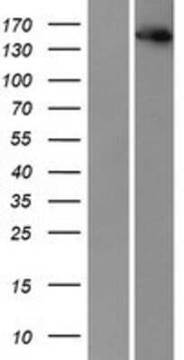 Western Blot: IKBKAP Overexpression Lysate [NBP2-07968]