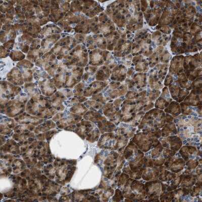 Immunohistochemistry-Paraffin: IKK epsilon/IKBKE Antibody [NBP1-83114]