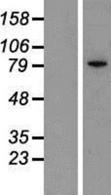 Western Blot: IKK epsilon/IKBKE Overexpression Lysate [NBP2-07392]