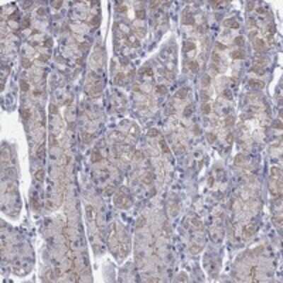 Immunohistochemistry-Paraffin: IKEPP Antibody [NBP3-17195]