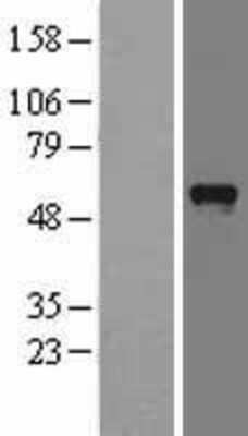 Western Blot: IKEPP Overexpression Lysate [NBL1-14270]