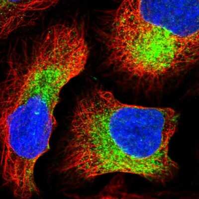 Immunocytochemistry/ Immunofluorescence: IKIP Antibody [NBP2-58695]