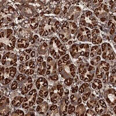 Immunohistochemistry-Paraffin: IKIP Antibody [NBP1-92022]
