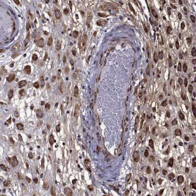 Immunohistochemistry-Paraffin: IKIP Antibody [NBP1-92022]