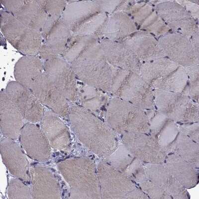 Immunohistochemistry-Paraffin: IKIP Antibody [NBP1-92022]