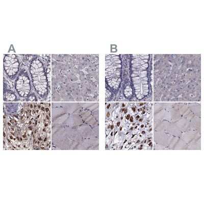 Immunohistochemistry-Paraffin: IKIP Antibody [NBP1-92022]