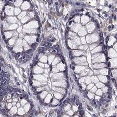 Immunohistochemistry-Paraffin: IKIP Antibody [NBP1-92022]