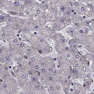 Immunohistochemistry-Paraffin: IKIP Antibody [NBP1-92022]