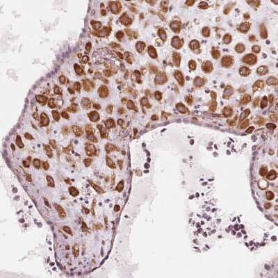 Immunohistochemistry-Paraffin: IKIP Antibody [NBP2-56525]