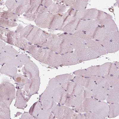 Immunohistochemistry-Paraffin: IKIP Antibody [NBP2-56525]