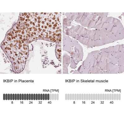 Immunohistochemistry-Paraffin: IKIP Antibody [NBP2-56525]