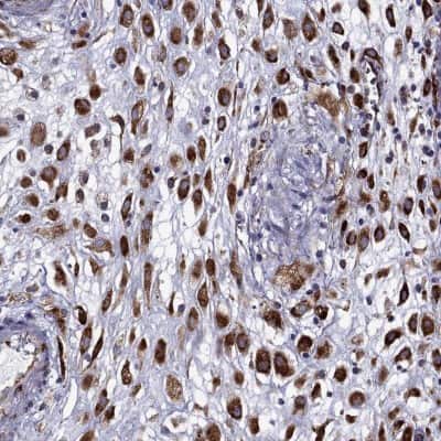 Immunohistochemistry-Paraffin: IKIP Antibody [NBP2-58695]