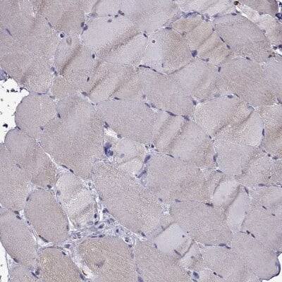 Immunohistochemistry-Paraffin: IKIP Antibody [NBP2-58695]