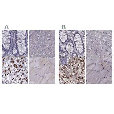 Immunohistochemistry-Paraffin: IKIP Antibody [NBP2-58695]