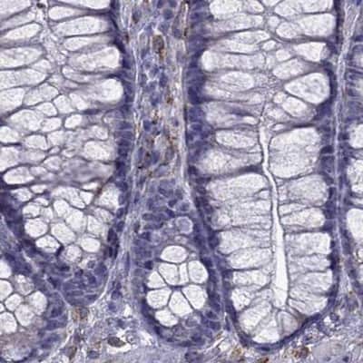 Immunohistochemistry-Paraffin: IKIP Antibody [NBP2-58695]