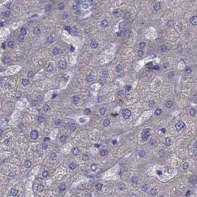 Immunohistochemistry-Paraffin: IKIP Antibody [NBP2-58695]