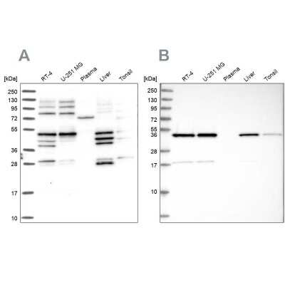 Western Blot: IKIP Antibody [NBP1-92022]