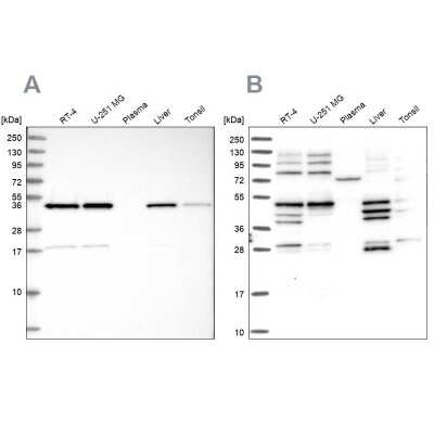 Western Blot: IKIP Antibody [NBP2-58695]
