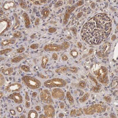 Immunohistochemistry-Paraffin: IKK alpha Antibody [NBP1-89634]