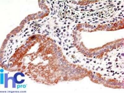 Immunohistochemistry-Paraffin: IKK beta Antibody (10AG2) - Azide and BSA Free [NBP2-80788]