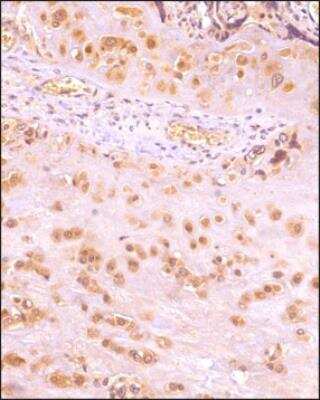Immunohistochemistry-Paraffin: IKK beta Antibody (10AG2) - BSA Free [NB100-56509]