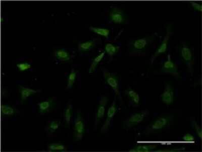 Immunocytochemistry/ Immunofluorescence: IKK beta Antibody (3C12) [H00003551-M08]