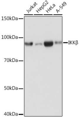 Western Blot: IKK beta Antibody (8X6V3) [NBP3-15810]