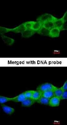 Immunocytochemistry/ Immunofluorescence: IKK beta Antibody [NBP1-32258]