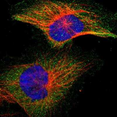 Immunocytochemistry/ Immunofluorescence: IKK beta Antibody [NBP1-87699]