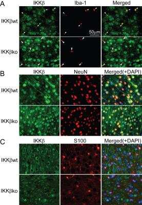 Immunohistochemistry-Paraffin: IKK beta Antibody [NB600-477]