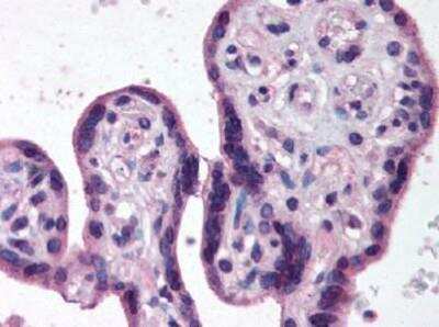 Immunohistochemistry-Paraffin: IKK beta Antibody [NB600-477]