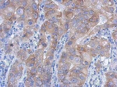 Immunohistochemistry-Paraffin: IKK beta Antibody [NBP1-32258]