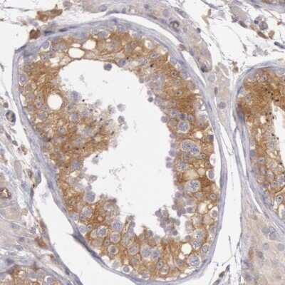 Immunohistochemistry-Paraffin: IKK beta Antibody [NBP1-87699]