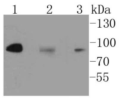 Western Blot: IKK beta Antibody (SN63-02) [NBP2-67659]