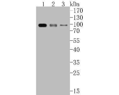 Western Blot: IKK beta Antibody (SN63-02) [NBP2-67659]