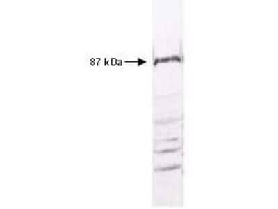 Western Blot: IKK beta Antibody [NB600-477]