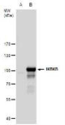 Western Blot: IKK beta Antibody [NBP1-32258]