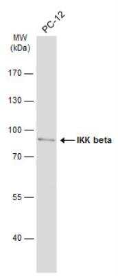 Western Blot: IKK beta Antibody [NBP1-32258]