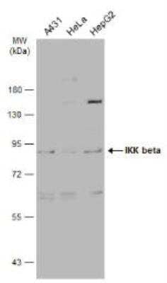 Western Blot: IKK beta Antibody [NBP1-32258]